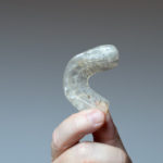 Night Guards for Teeth Grinding