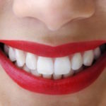 Dental Veneers vs Crowns