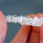 Invisalign® vs Traditional Metal Braces